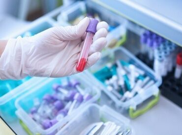 まずは先輩から基本的なことから教えてもらいます!
近隣への検体の配送などもお願いします!